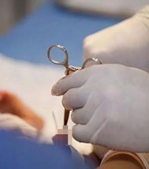 Cắt bao quy đầu có ảnh hưởng khi làm chuyện ấy