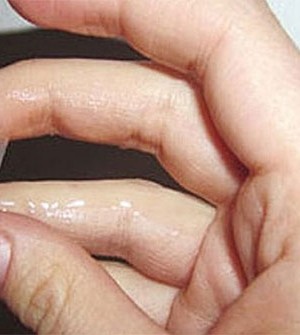 Khí hư ra nhiều và cách khắc phục