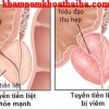 viêm tuyến tiền liệt