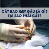 cắt bao quy đầu là gì